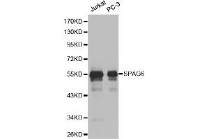 Western blot analysis of extracts of various cell lines, using SPAG6 antibody (ABIN6291215).