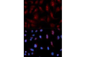 Immunofluorescence analysis of U2OS cell using PLCB1 antibody. (Phospholipase C beta 1 antibody)
