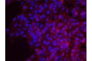 Immunofluorescence (IF) image for anti-Epidermal Growth Factor Receptor (EGFR) antibody (ABIN2664938) (EGFR antibody)