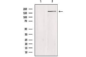 Western blot analysis of extracts from Hela, using ZC3H13 Antibody. (ZC3H13 antibody  (C-Term))