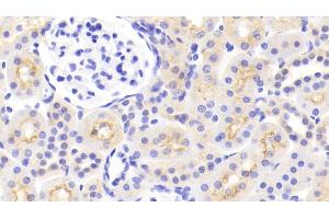 Detection of MAOA in Rat Kidney Tissue using Polyclonal Antibody to Monoamine Oxidase A (MAOA)