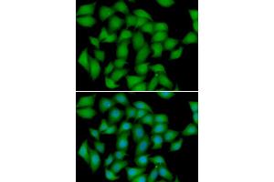Immunofluorescence analysis of HeLa cell using ATOX1 antibody. (ATOX1 antibody)
