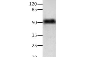 Western Blot analysis of Human lymphoma tissue using ACTG1 Polyclonal Antibody at dilution of 1:350 (Actin, gamma 1 antibody)