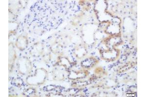 Formalin-fixed and paraffin embedded human kidney labeled with Anti-Phospho-eNOS (Thr495) Polyclonal Antibody, Unconjugated  at 1:200 followed by conjugation to the secondary antibody and DAB staining (ENOS antibody  (pThr495))