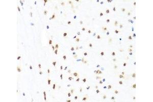 Immunohistochemistry of paraffin-embedded Mouse brain using GATA2 Polyclonal Antibody at dilution of 1:100 (40x lens). (GATA2 antibody)