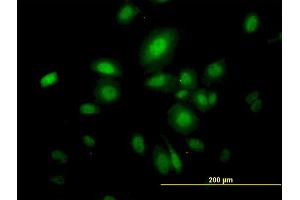 Immunofluorescence of monoclonal antibody to SEPT10 on HeLa cell. (Septin 10 antibody  (AA 1-454))