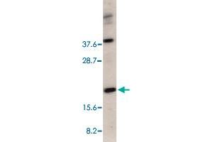 Western blot analysis of CRADD in HeLa total cell lysate with CRADD polyclonal antibody  at 1 ug/mL . (CRADD antibody  (C-Term))