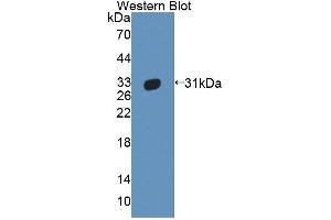 Detection of Recombinant ABCB11, Human using Polyclonal Antibody to ATP Binding Cassette Transporter B11 (ABCB11) (ABCB11 antibody  (AA 421-663))