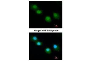 ICC/IF Image Immunofluorescence analysis of paraformaldehyde-fixed A549, using Ubiquilin-1, antibody at 1:200 dilution. (Ubiquilin 1 antibody)