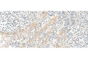Immunohistochemistry of paraffin-embedded Human tonsil tissue using PSCA Polyclonal Antibody at dilution of 1:25(x200) (PSCA antibody)