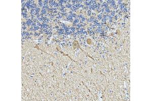 anti-Calbindin (CALB1) (AA 2-261) antibody