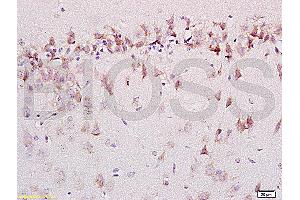 Formalin-fixed and paraffin embedded labeled with rat brain Anti-AMBRA1 Polyclonal Antibody, Unconjugated (ABIN704741) 1:200 followed by conjugation to the secondary antibody and DAB staining (AMBRA1 antibody  (AA 221-320))