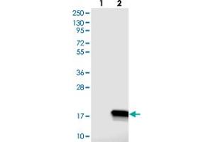 Western blot analysis of Lane 1: Negative control (vector only transfected HEK293T lysate), Lane 2: Over-expression Lysate (Co-expressed with a C-terminal myc-DDK tag (~3. (C14ORF119 antibody)