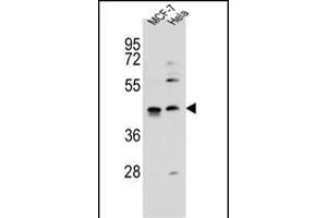 ZN Antibody (C-term) (ABIN655885 and ABIN2845286) western blot analysis in MCF-7,Hela cell line lysates (35 μg/lane). (ZNF384 antibody  (C-Term))