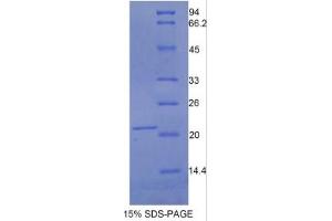 SDS-PAGE (SDS) image for Leukemia Inhibitory Factor Receptor alpha (LIFR) ELISA Kit (ABIN6730977)