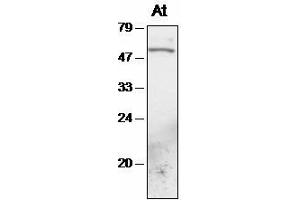 Western blot analysis of Arabidopsis chloroplast proteins with anti-TAK1 (Serine/threonine Protein Kinase (At4g02630) antibody)
