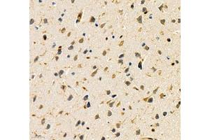 Immunohistochemistry of paraffin embedded mouse brain using ANXA3 (ABIN7073065) at dilution of 1: 200 (400x lens) (Annexin A3 antibody)
