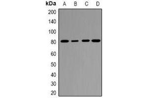 Western blot analysis of EPS8L1 expression in Hela (A), COLO205 (B), mouse uterus (C), rat placenta (D) whole cell lysates. (EPS8-Like 1 antibody)