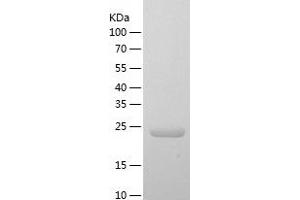 Western Blotting (WB) image for Reelin (RELN) (AA 26-254) protein (His tag) (ABIN7286804) (Reelin Protein (RELN) (AA 26-254) (His tag))