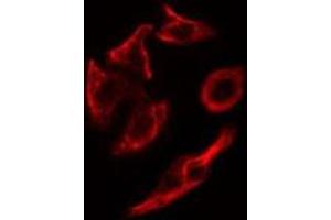 ABIN6278818 staining HepG2 cells by IF/ICC. (COL9A1 antibody  (Internal Region))