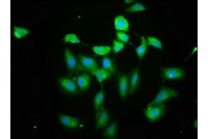 Immunofluorescence staining of Hela cells cells with ABIN7163449 at 1: 200, counter-stained with DAPI. (PIH1D1 antibody  (AA 1-290))