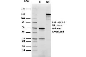 SDS-PAGE Analysis. (Recombinant Myoglobin antibody)