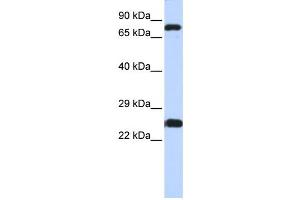 Western Blotting (WB) image for anti-Zinc Finger Protein 799 (ZNF799) antibody (ABIN2458232) (ZNF799 antibody)