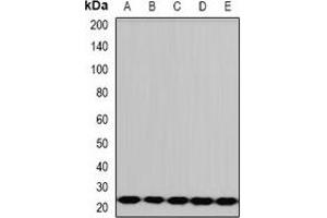 Western blot analysis of PCMT1 expression in HepG2 (A), A431 (B), mouse liver (C), rat brain (D), rat heart (E) whole cell lysates.