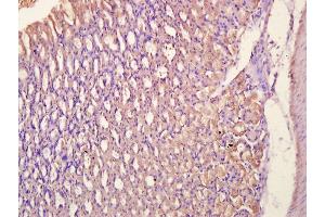 Paraformaldehyde-fixed, paraffin embedded Mouse Stomach, Antigen retrieval by boiling in sodium citrate buffer (pH6. (SYK antibody  (pTyr323))