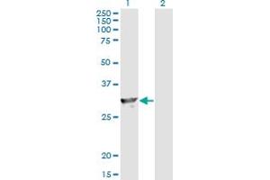 Western Blot analysis of SPR expression in transfected 293T cell line by SPR monoclonal antibody (M01), clone 4F2.