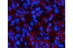 Immunofluorescence analysis of Mouse spleen tissue using ATG7 Monoclonal Antibody at dilution of 1:200. (ATG7 antibody)