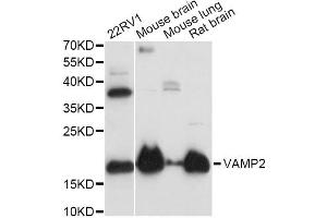 Western blot analysis of extracts of various cell lines, using VAMP2 antibody (ABIN1875306) at 1:3000 dilution. (VAMP2 antibody)