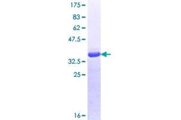 RENT1/UPF1 Protein (AA 1019-1116) (GST tag)