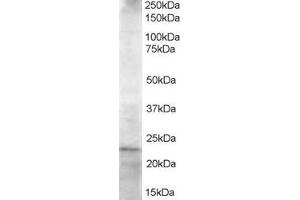 ABIN184891 staining (1. (UBE2K antibody  (C-Term))