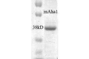 SDS-PAGE of ~38 kDa his-tagged mouse Aha1 protein (ABIN1686732, ABIN1686733 and ABIN1686734).