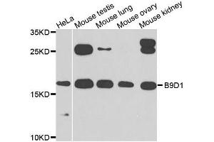 Western Blotting (WB) image for anti-B9 Protein Domain 1 (B9D1) (AA 1-130) antibody (ABIN6137409)