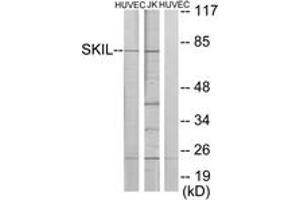 Western blot analysis of extracts from HuvEc/Jurkat cells, using SKIL Antibody.