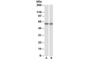 Western blot testing of nuclear mouse NIH3T3 [A] and nuclear human HeLa [B] lysates with PDCD4 antibody at 1ug/ml. (PDCD4 antibody)