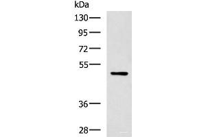 Western blot analysis of MCF-7 cell lysate using PAX2 Polyclonal Antibody at dilution of 1:400 (PAX2A antibody)