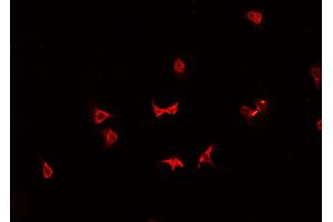 ABIN6266906 staining K-562 cells by IF/ICC. (HSPH1 antibody  (C-Term))