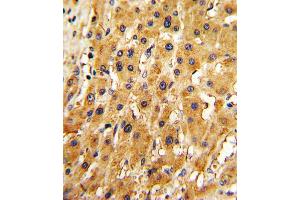 Immunohistochemistry (IHC) image for anti-Adenine Phosphoribosyltransferase (APRT) antibody (ABIN3001698) (APRT antibody)