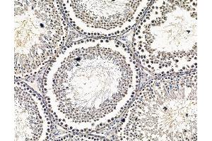 ABIN7096587 and ABIN7100651 at 1/100 staining rat testis tissue by IHC-P.