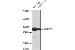 Western blot analysis of extracts of various cell lines, using AMPKβ1 Rabbit mAb (ABIN7269654) at 1:1000 dilution.