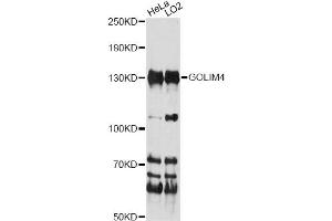 Western blot analysis of extracts of various cell lines, using GOLIM4 antibody (ABIN6291706) at 1:1000 dilution. (Golgi Integral Membrane Protein 4 (GOLIM4) antibody)