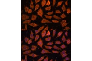 Immunofluorescence analysis of L929 cells using Legumain (Legumain (LGMN)) Polyclonal Antibody (ABIN6128201, ABIN6143172, ABIN6143173 and ABIN6214867) at dilution of 1:100 (40x lens). (LGMN antibody  (AA 18-323))