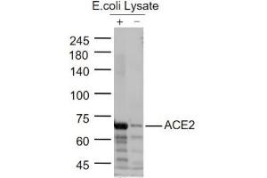 Lane 1:ACE2 Protein Overexpression E. (ACE2 antibody  (AA 351-450))
