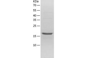 Western Blotting (WB) image for Nucleolar Protein 16 (NOP16) (AA 1-178) protein (His tag) (ABIN7124221)