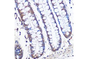 Immunohistochemistry of paraffin-embedded human colon using ERK5 Rabbit mAb (ABIN1680723, ABIN3018327, ABIN3018328 and ABIN7101595) at dilution of 1:100 (40x lens). (MAPK7 antibody)