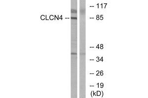 Western Blotting (WB) image for anti-Chloride Channel 4 (CLCN4) (Internal Region) antibody (ABIN1851086) (CLCN4 antibody  (Internal Region))