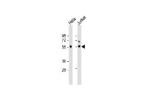 All lanes : Anti- Antibody at 1:1000 dilution Lane 1: Hela whole cell lysate Lane 2: Jurkat whole cell lysate Lysates/proteins at 20 μg per lane. (PP5 antibody  (C-Term))